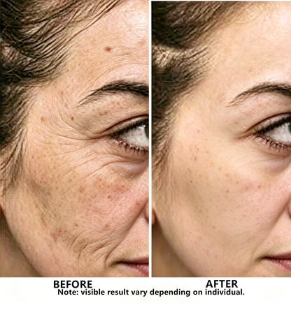 Brightening & Anti-Aging Face Serum with Vitamin C – Hydrating & Barrier Repair